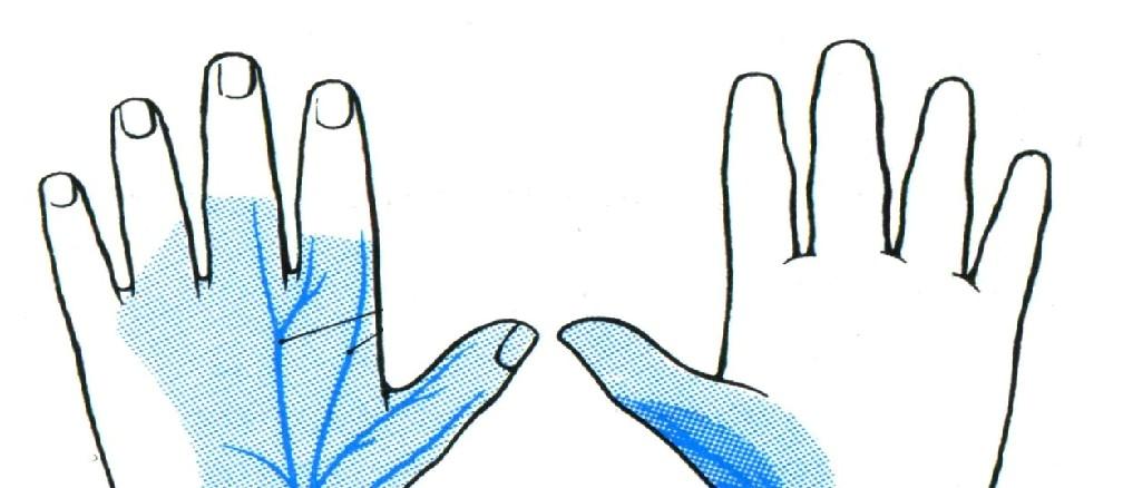 posterior r.