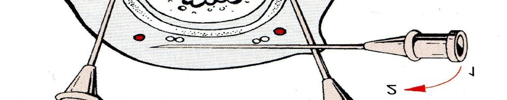 a) beszúrási pontok helyei ( metacarpophalangealis