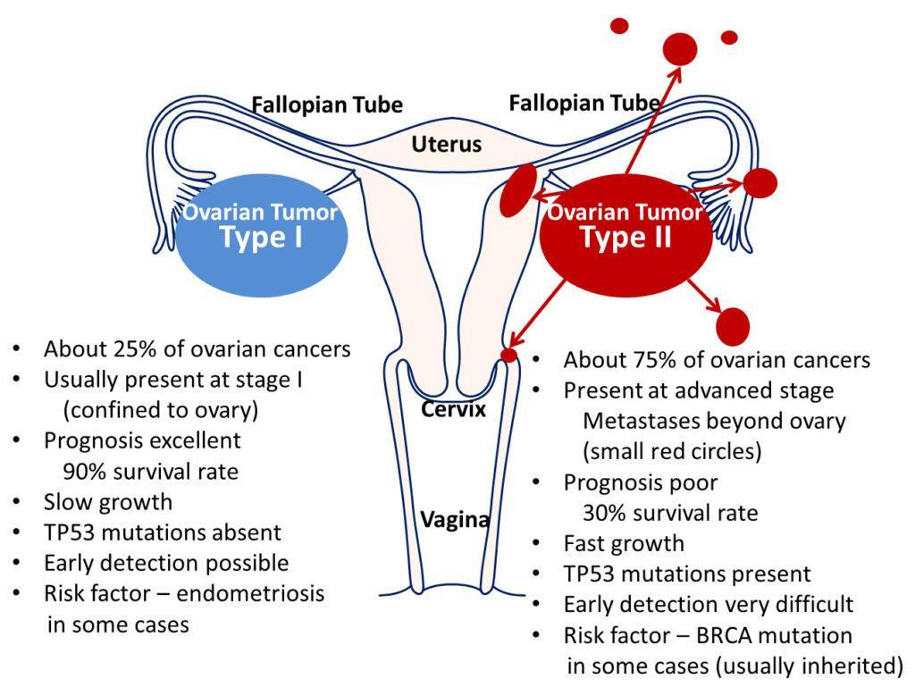 Robert J. Kurman, Ie-Ming Shih, atlasofscience.org Az ovarium carcinomák 25%-a Általában korai stádiumú (St.