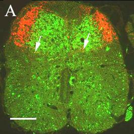 hátsó szarv perifériás csíkjában, az áttetszı területnek megfelelıen jelentkezett, míg a vastag érzı rostok végzıdésére jellemzı vesicular glutamate transporter 1 (VGLUT1) jelölés a hátsó szarvnak a