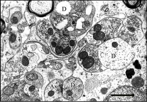 Mérték: 0,5 µm Jellemzı szinaptikus elrendezıdésként találtuk a több (2-4) preszinaptikus végzıdésbıl álló axodendritikus szinaptikus együttest, amit koszorú szinapszisnak neveztünk (36.