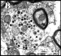 Mérték: 0,5 µm.