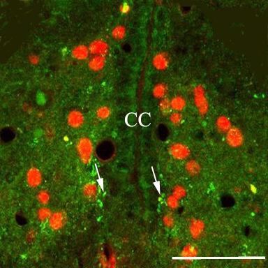 Kilenc optikai szint összegzése. Mérték: 100 µm 57. ábra. Patkány FT, kettıs immunfestés.