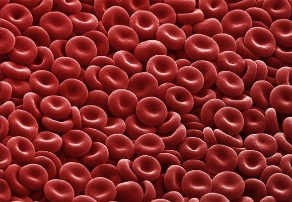 Vérkészítmények: VVS CC. Vörösvérsejt koncentrátum Gondos kezelés hemolízis veszély!