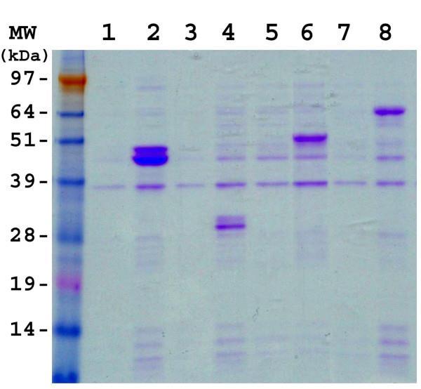 Western blot fehérjék megfestése a gélben http://delliss.people.cofc.