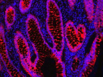 Immunhisztokémia (IHC) https://www.thermofisher.