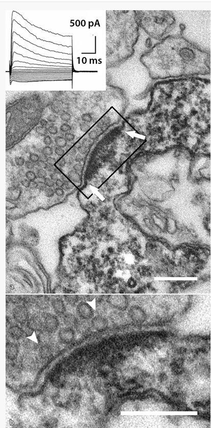 Neuron Glia