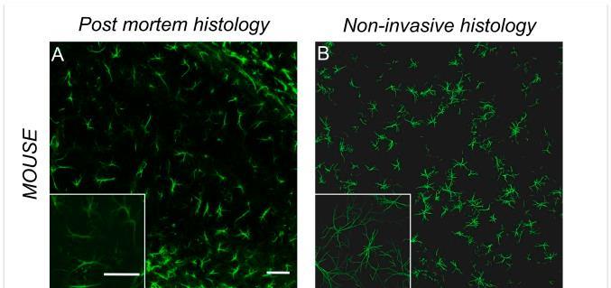 in intact mammalian tissues Nikolay 2001 ADC: apparent diffusion coefficient valós modell!