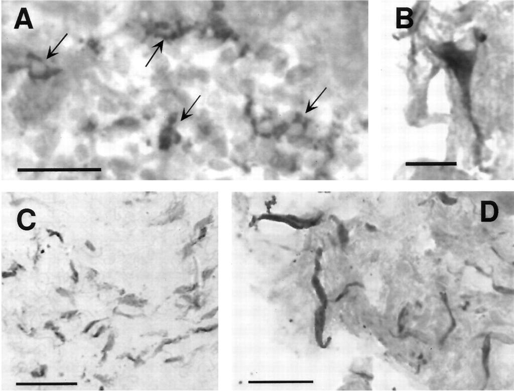 Signaling through the vagus nerve LPS-induced IL-1 immunoreactivity in the abdominal vagus nerve