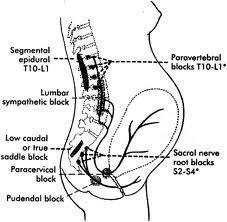 1. stádium: viscerális fájdalom, méh alsó része és a cervix (perifériás és centrális szenzitizáció miatt erősödik) 2.