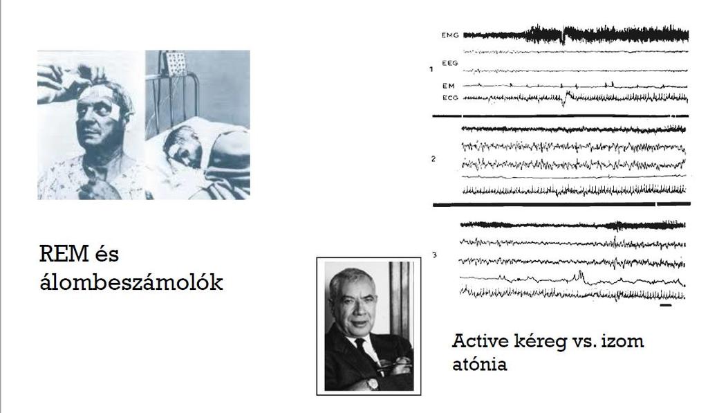 REM alvás avagy paradox alvás: a modern álomkutatás