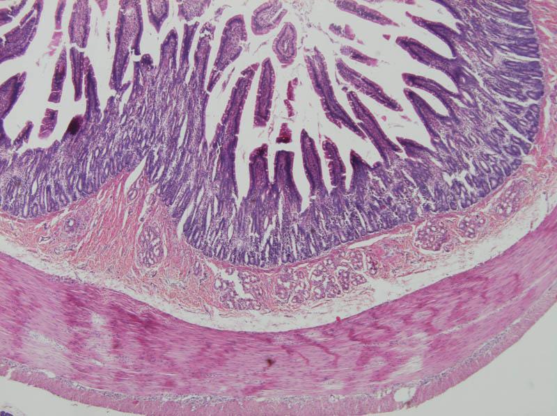 Duodenum (1) bélbolyhok