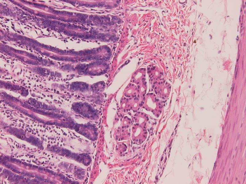 Duodenum (2) gll.