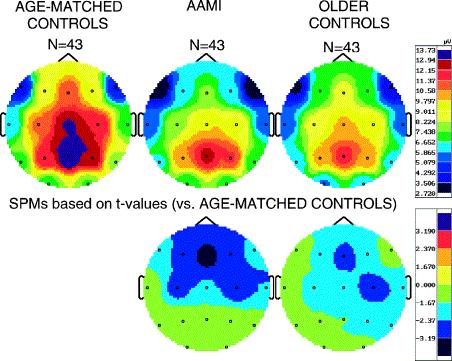 AAMI P. Anderer et al.