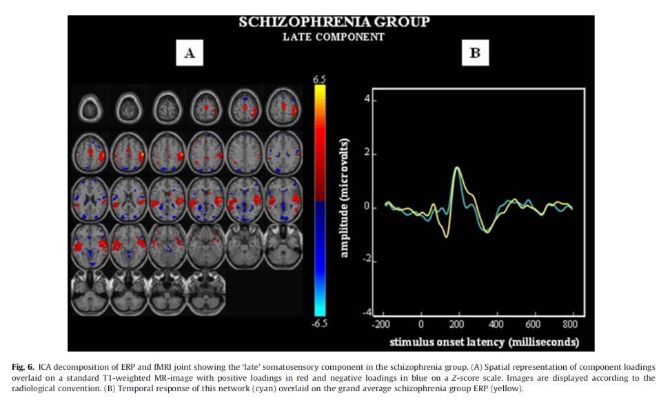 Alfa gamma oszcilláció & sch EEG+fMRI Szenzoros