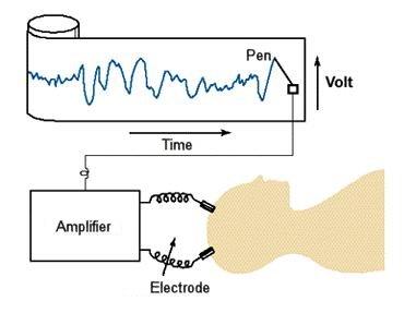 EEG,