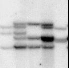 A FVIII ggéninverzió kimutatása Southern blot technikával Várható RFLP mintázatok Bcl I emésztést követően RFLP mintázatok: I C1 N C2 II 21,5 20 17,5 16