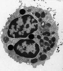 Típusaik Neutrofil granulocita: A neutrofilek a bakteriális vagy gombás fertőzésekkel, és más apró gyulladásos folyamatokkal szállnak szembe, és általában ők válaszolnak először a mikrobiális