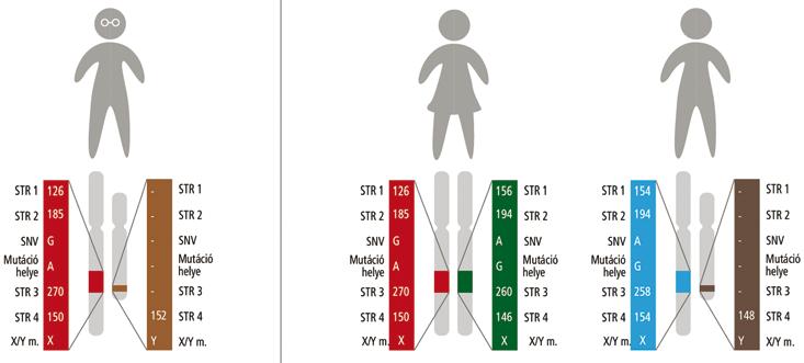 Preimplantációs Genetikai Diagnosztika A- és B típusú hemofíliában Egy PGD-PCR beállítás végeredménye hemofíliával sújtott családban A PGD beállításhoz számos SNV és STR markert tesztelünk a