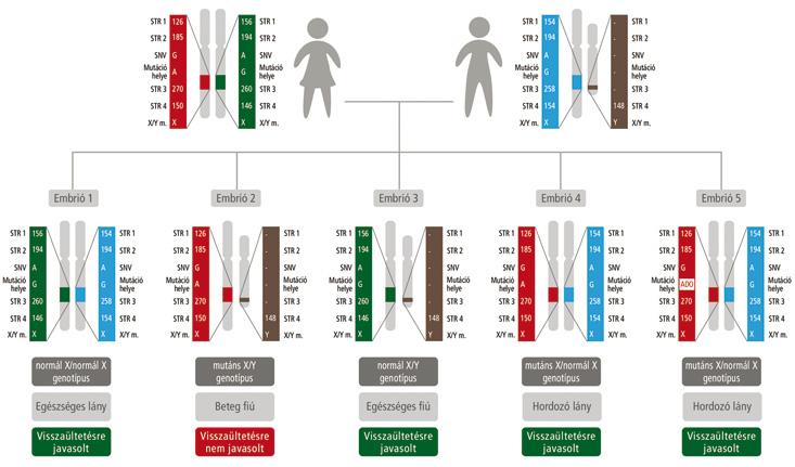 Az itt bemutatott ábrán a leendő szülők és a nő beteg édesapjának a PGD szempontjából informatív markerei láthatók.