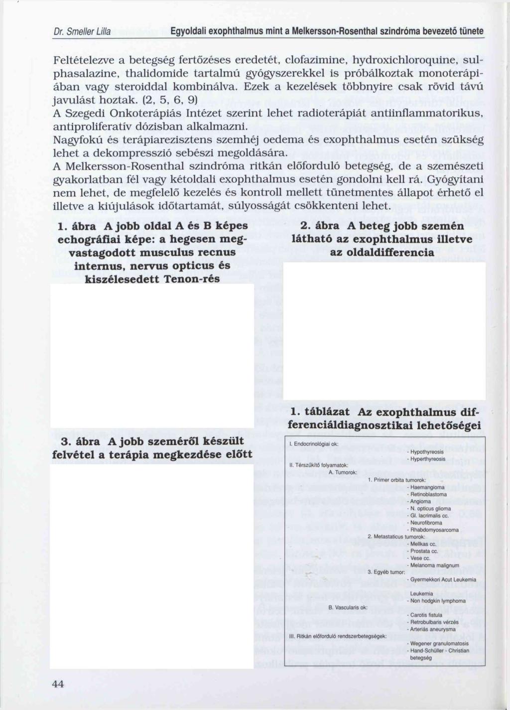 Dr. Smeller Ulla Feltételezve a betegség fertőzéses eredetét, clofazimine, hydroxichloroquine, sulphasalazine, thalidomide tartalmú gyógyszerekkel is próbálkoztak monoterápiában vagy steroiddal