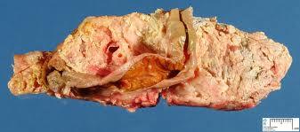 ) hiány, ér- és ideggyulladás, szív-izomkárosodás, gastro-intestinális megbetegedéseket: