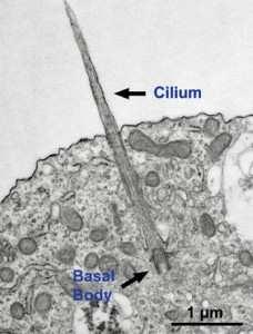 A cystás vesebetegségekben a ciliákban lévı fehérjék károsodnak mutáció miatt.