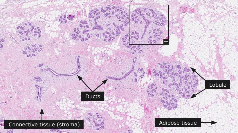 Normál emlő szövettana Lobulus (TDLU) Ductusok Kötőszövet