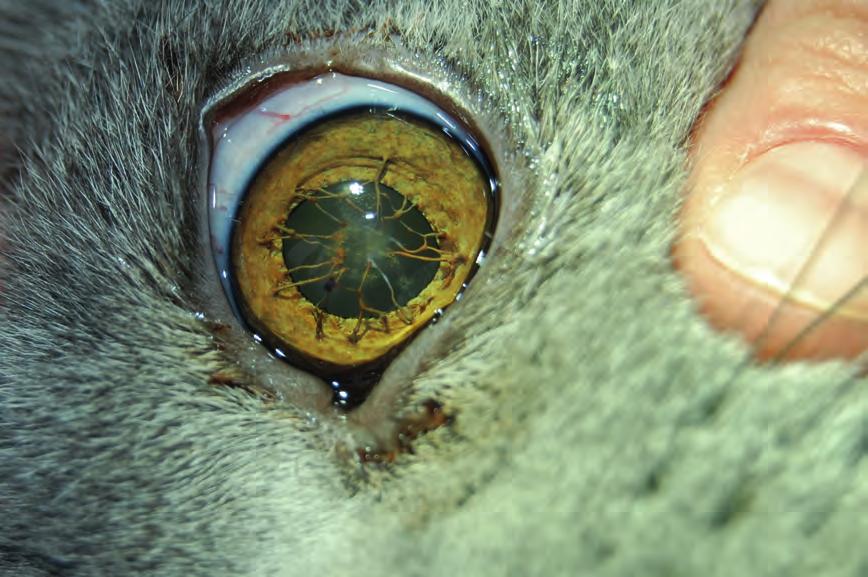 Az iris collarette-ről szálak térnek a szaruhártya endotheliumához, melyeket perzisztáló pupillaris