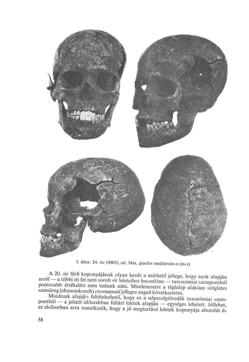 3. ábra: 24. sir (95), nő, Mat, gracilis mediterrán-x (m-x) A 2.