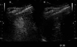 has, emlő, nyirokrégiók Belső 2D, 3D, B mód, CD, PD Endocavitális, Endorectalis Endoscopos Endooesophagealis Endogastricus