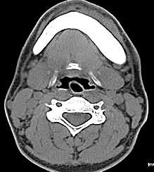 MD-CT