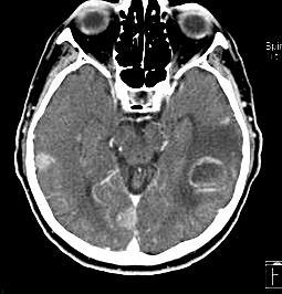 PET/CT MRI agy