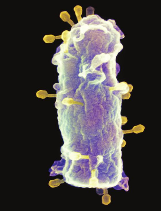 5. Bakteriofágok a közönséges bélbaktérium felszínén Keress rá!