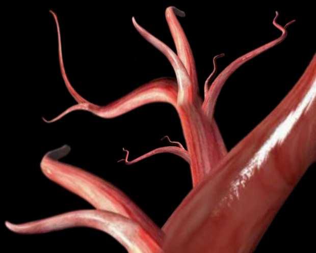2003; vol. 44. E-ARVO abstract 1828. 2. Gaudreault J et al. Invest Ophthalmol Vis Sci. 2003; vol. 44. E-ARVO abstract 3942. 3. Krzystolik MG et al.