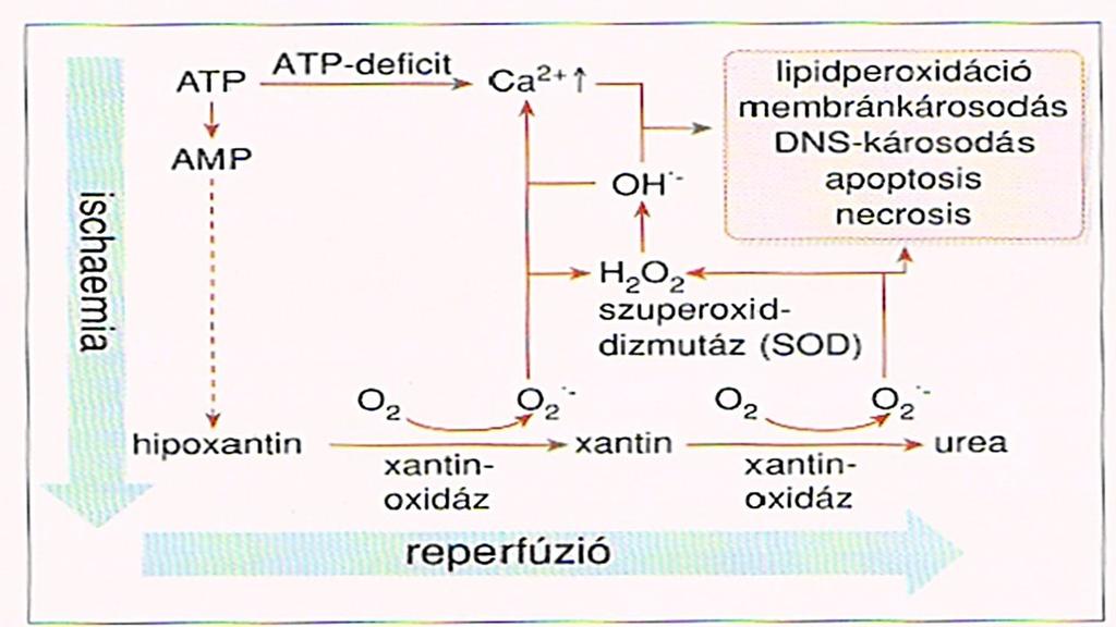 4. ábra. Az iszkémiás és reperfúziós károsodás létrejötte és következményei. (OH - : hidroxil-gyök; O 2 - : szuperoxid-gyök), (M.
