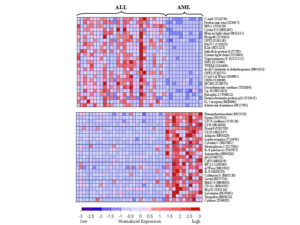Expression levels of 50 genes most highly correlated with the acute lymphoblastic leukemia (ALL) and acute myeloid leukemia (AML)