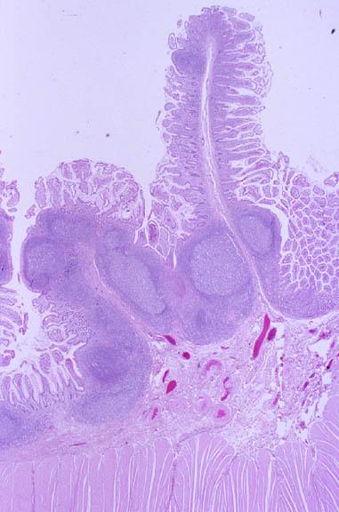 Jejunum hosszmetszet: a belső körkörös izomréteg