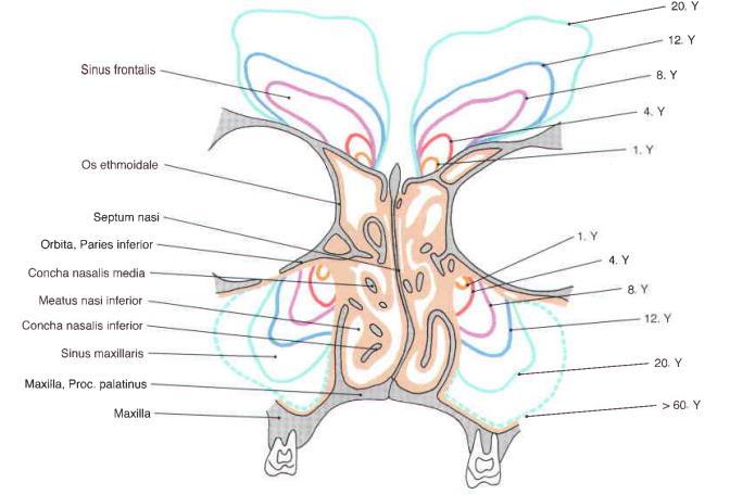 1. ábra Sinus paranaseles [5] A sinus maxillaris az alapjával az orrüreg felé tekintő piramis.