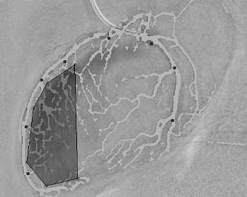 Cardiac DSA Vessel masking ROI definition 6 0 5 0 Time-density curve density 4 0 3 0 2 0 T max G max G max /T max measurement 1 0 0 1 2 1 4 1 6 1 8 1 1 0 1 1 2 1 1 4 1 1 6 1 time Figure 5.