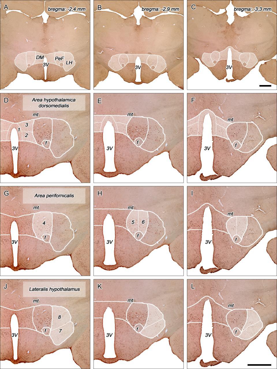 1. ábra. A dorsolateralis hypothalamus területeinek és szubdivízióinak topográfiája.