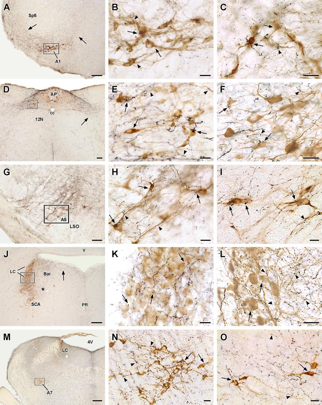 19. ábra. Orexin A-tartalmú rostok (fekete) és tirozin-hidroxiláz (TH)-pozitív neuronok (barna) az alsó agytörzs noradrenalin sejtcsoportjainak területén.