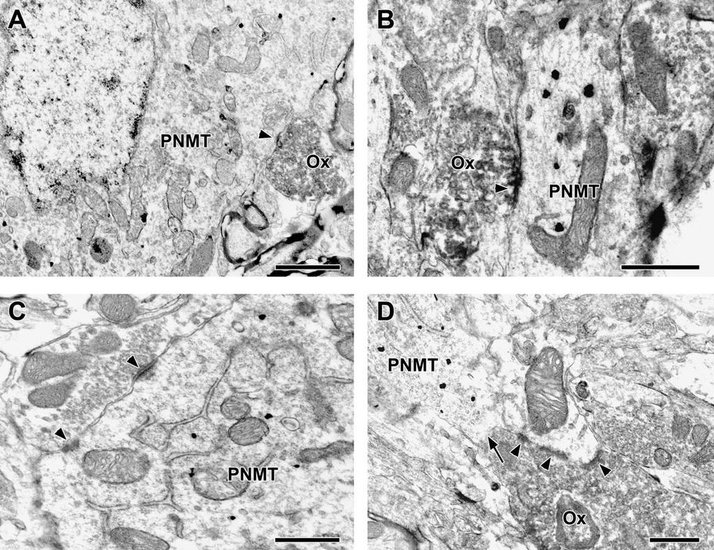 21. ábra. Orexin A-tartalmú axonterminálisok a C1 és C2 adrenalin sejtcsoport területén.