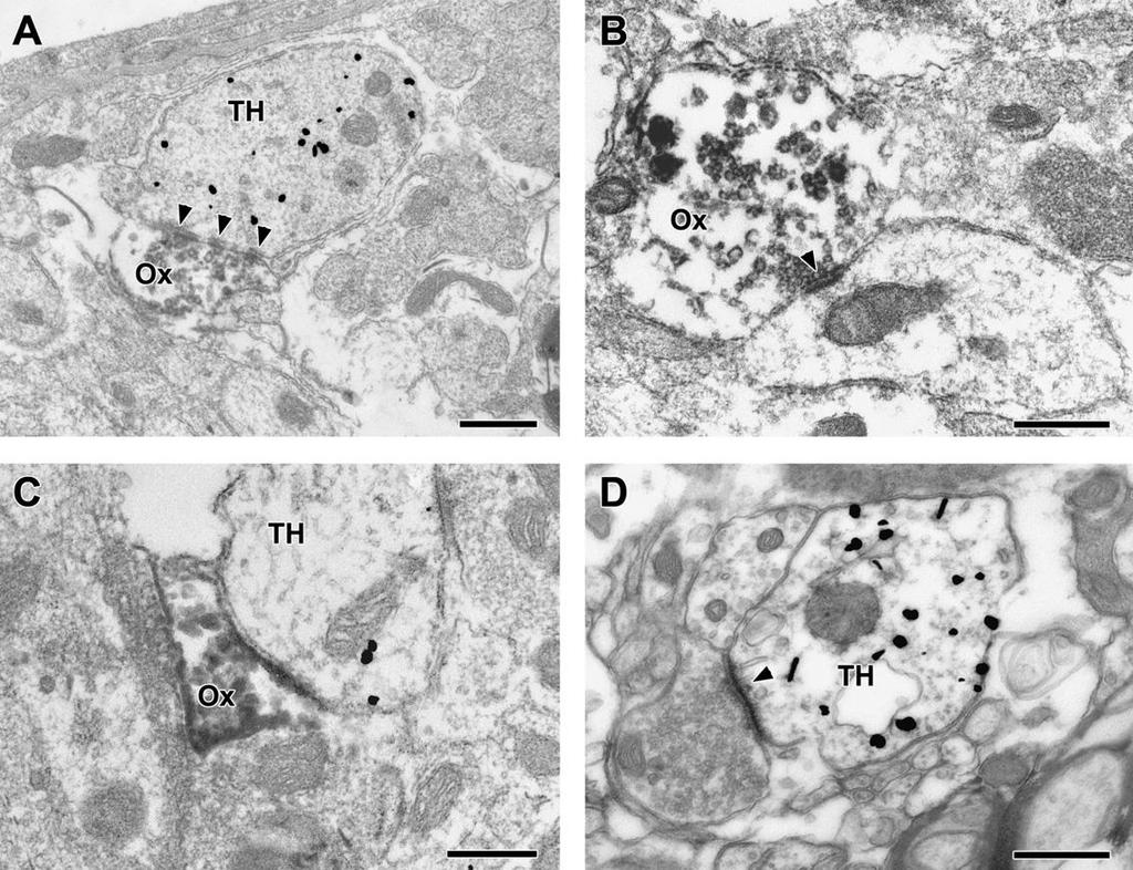 22. ábra. Orexin A-tartalmú axonterminálisok a nucleus tractus solitarii területén.