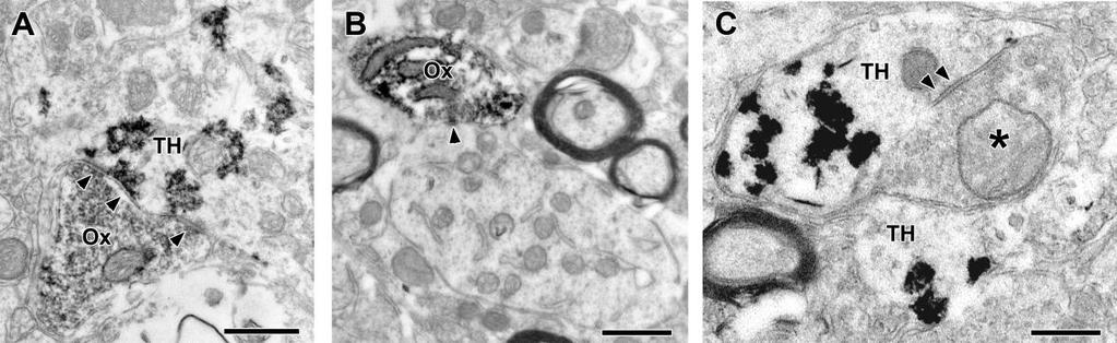 23. ábra. Orexin A-tartalmú axonterminális a locus coeruleus területén.