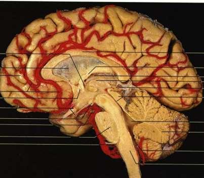 convex felszínből Arteria cerebralis posterior (PCA)