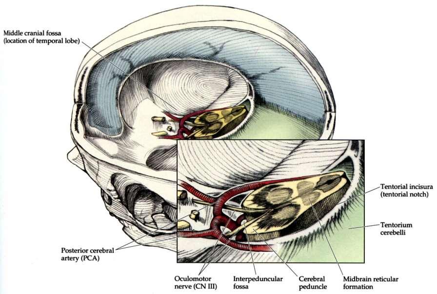 Az incisura