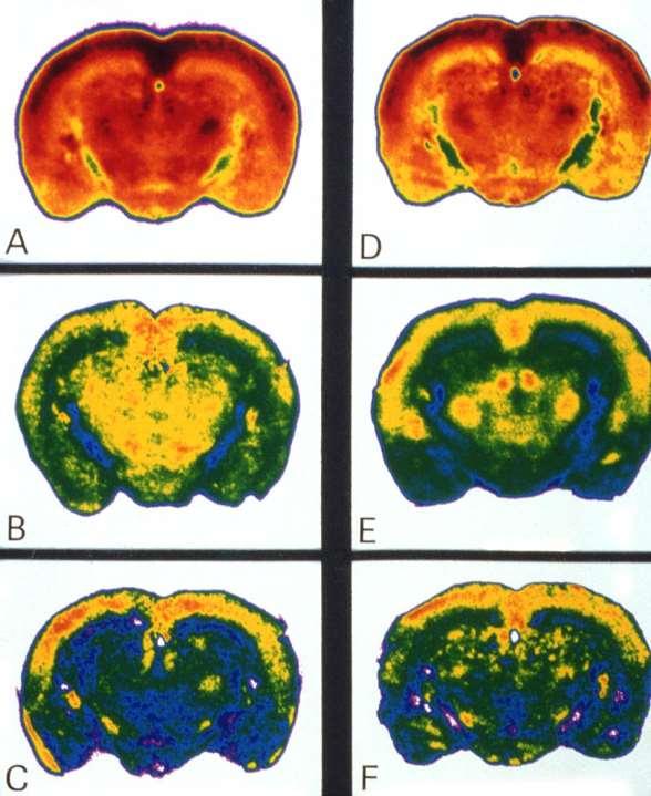 KEMOREGULÁCIÓ Az agyi vérátáramlás (Cerebral Blood Flow; CBF) a működéstől függ.