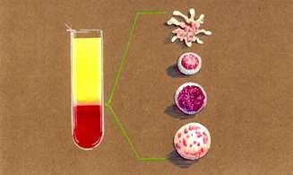 Vér alkotó elemeinek szeparálása Platelets Platelet depletion (PLTD) Therapeutic Plasma Exchange (TPE) Plasma Plasma Lymphocytes Red Blood Cell Exchange (RBCX) Packed Red