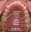 Hungary Oral Health